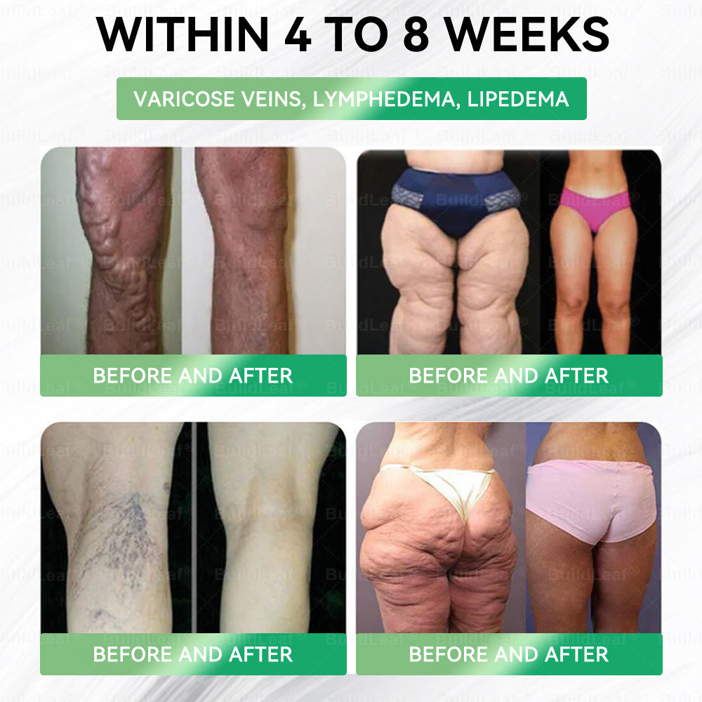 Official Store | BuildLeafยฎ GLP-1 8-in-1 Slim & Healthy Oral Solution (Once a day, results in 7 days), With 100 Billion CFU Active Probiotics โ
 Supports weight management, heart health, diabetes, gut & womenโs health, while firming skin & boosting energy.