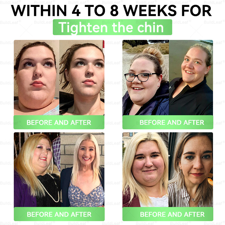 Official Store | BuildLeafยฎ GLP-1 8-in-1 Slim & Healthy Oral Solution (Once a day, results in 7 days), With 100 Billion CFU Active Probiotics โ
 Supports weight management, heart health, diabetes, gut & womenโs health, while firming skin & boosting energy.